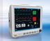 Máquina do monitor paciente da medida de NIBP com função de gestão paciente da entrada de informação